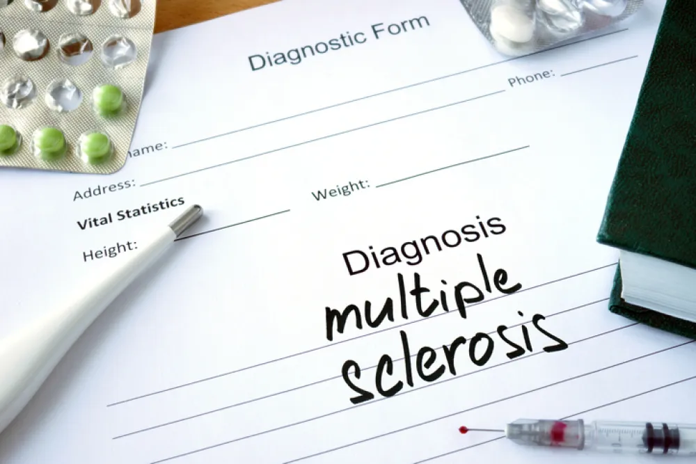 Foto de un informe medico donde aparece escrito a mano diagnostico esclerosis multimple en ingles