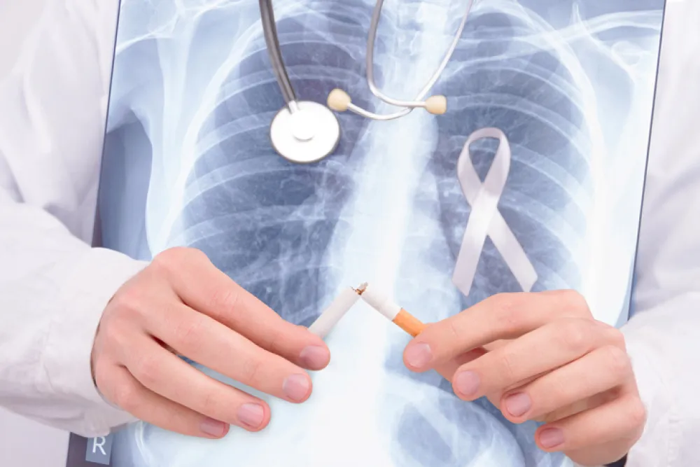 Foto con una radiografía de pulmones, y unos manos que rompen un cigarrillo