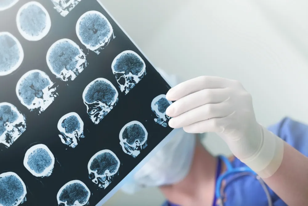 Foto de un médico observando una radiografía del cerebro