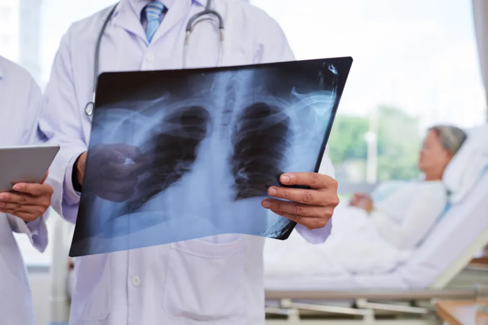 Foto radiografía de pulmón